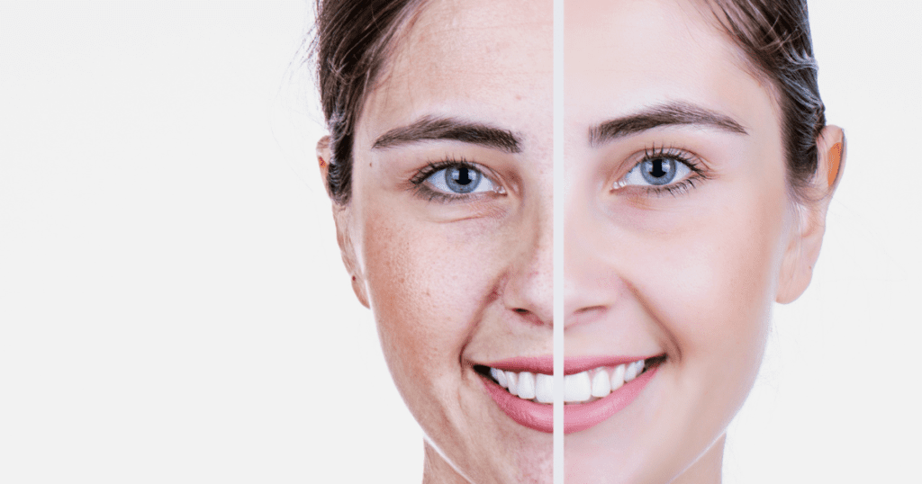 The Ultimate Guide to Choosing the Right Facial Cream for Your Skin Type